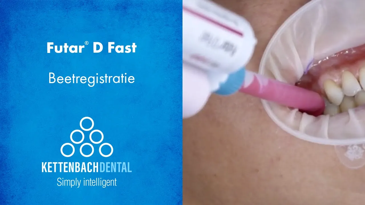 So Fast With Futar® D Fast