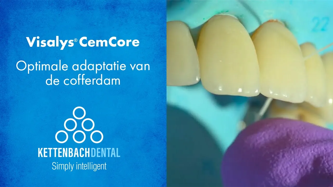 Optimale Adaptatie Van De Cofferdam Door Erik Jan Muts