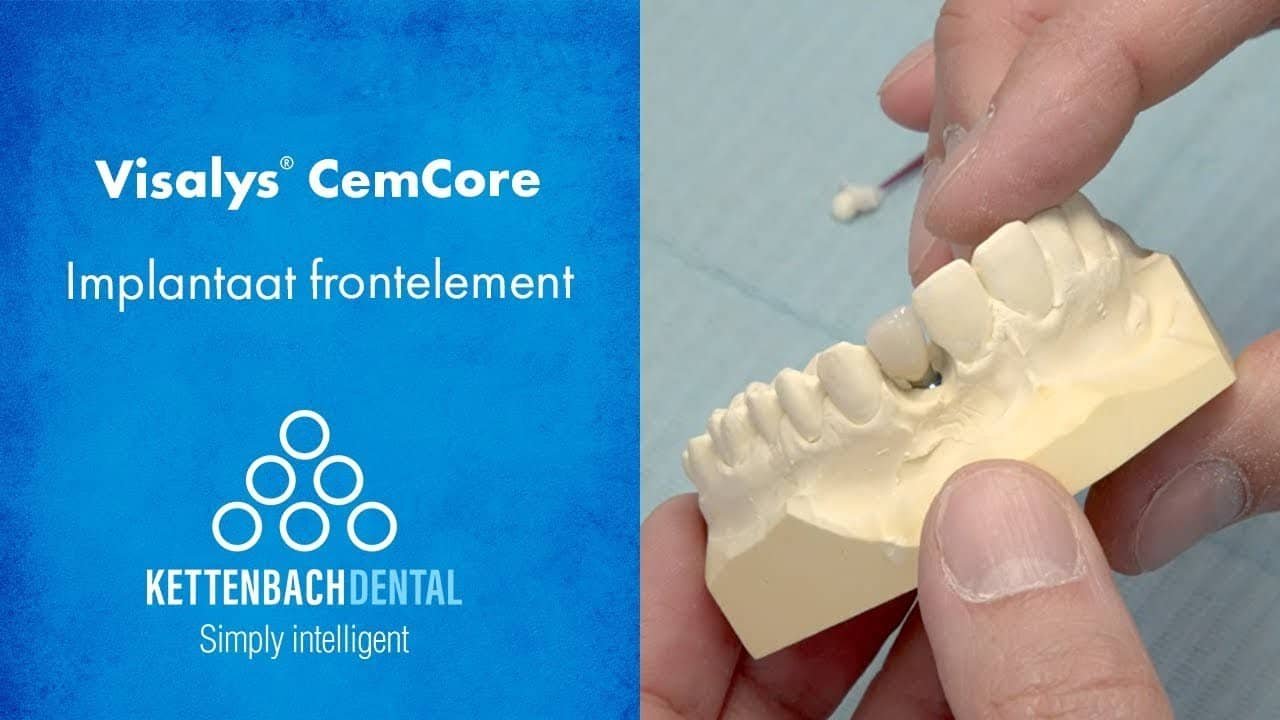 Visalys® CemCore als cementeercomposiet bij Implantologie