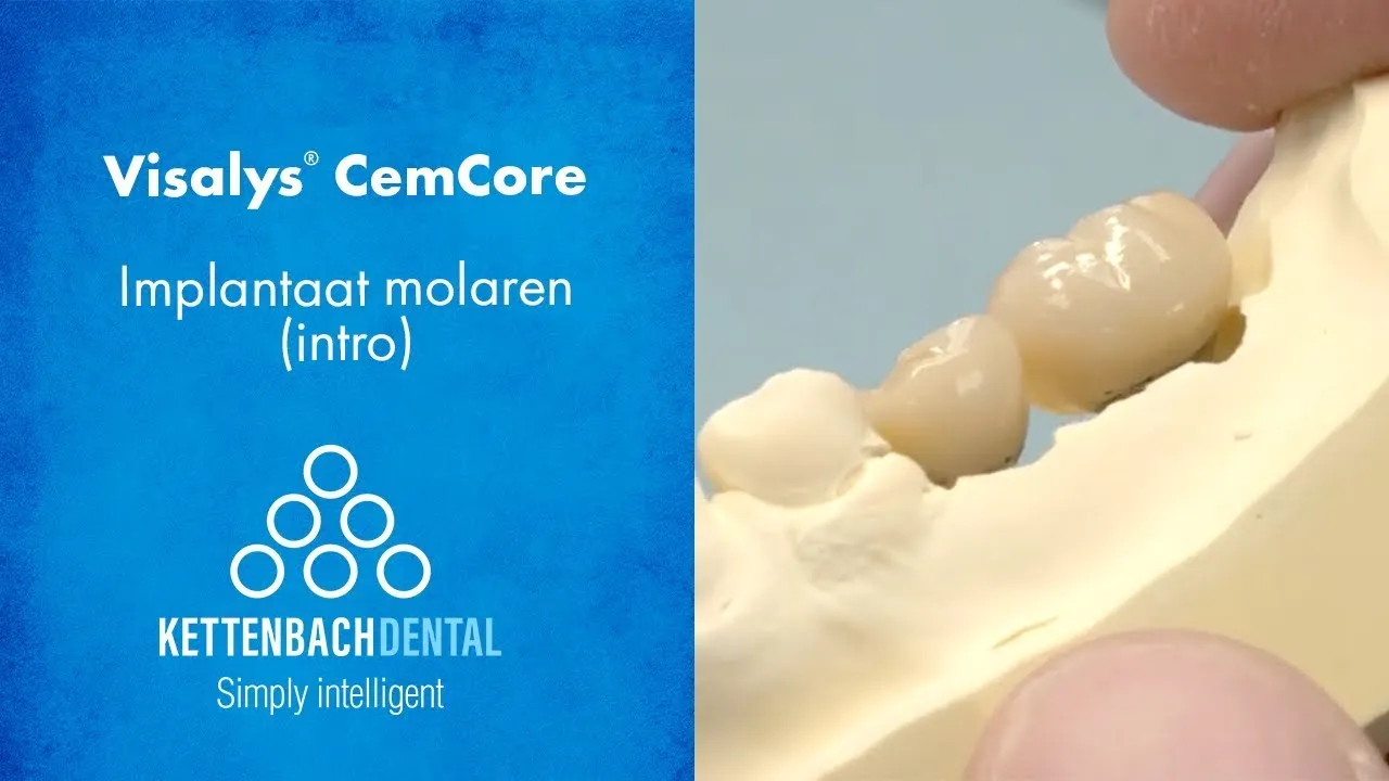Visalys® CemCore als cementeercomposiet bij Implantologie Intro